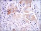 IL1B Antibody